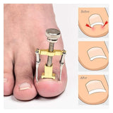 Ingrown Toenail Lifter Toe Nail Recover Correction Tool