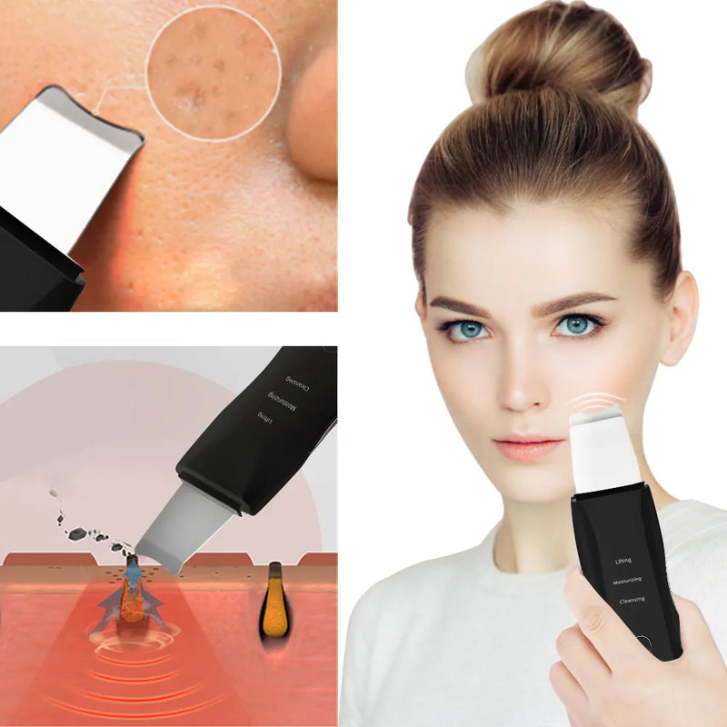 Ultrasonic Skin Scrubber - Gentle Face Shovel & Applicator Tool for Pore Cleansing, Blackhead Removal