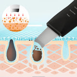 Ultrasonic Skin Scrubber - Gentle Face Shovel & Applicator Tool for Pore Cleansing, Blackhead Removal